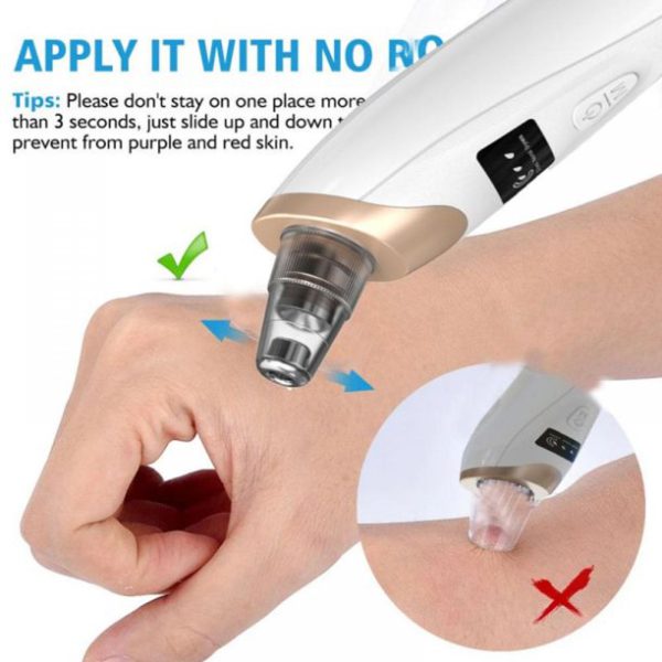 5-in-1 Electric Blackhead Remover Acne Treatment and Facial Pore Cleaner.
