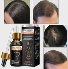 Ginger Hair Growth Serum – Nourishing & Anti-Hair Loss Oil